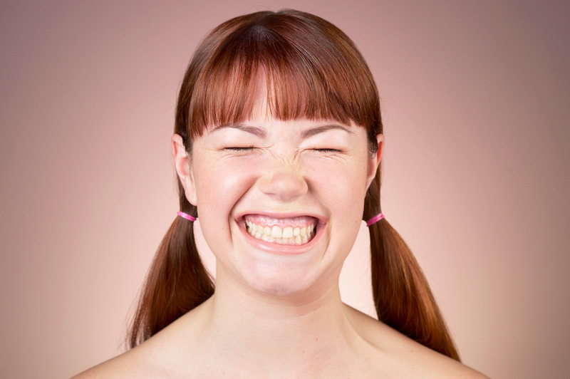 Gummysmile / Tannkjøttsmil Fjerning av tannkjøttsmil med botox