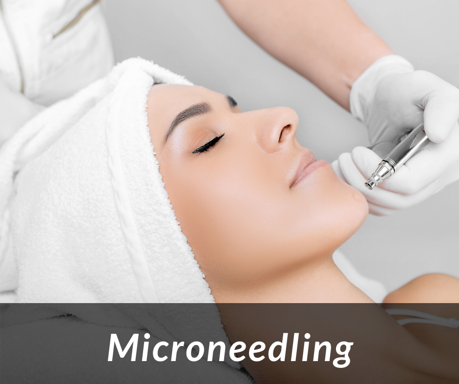 Microneedling Oslo